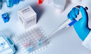 STUDIU: testele RT-PCR nu pot fi luate în considerare în evaluarea COVID-19