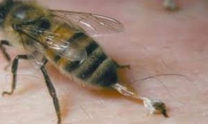 Un bărbat a decedat după ce a fost înțepat de o albină
