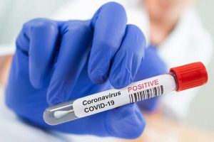 Statele Unite ale Americii renunță la testele RT-PCR pentru depistarea COVID