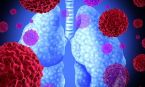 BioNTech și Regeneron dezvoltă un MEDICAMENT împotriva cancerului pulmonar