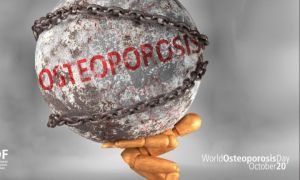 20 octombrie - Ziua Mondială a Osteoporozei