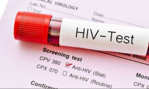 Peste 17.500 de persoane din România sunt infectate cu HIV