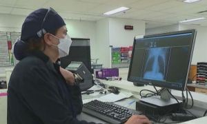 Primul PACIENT din România confirmat cu triplă infecție: GRIPĂ, COVID și virus sincițial respirator 