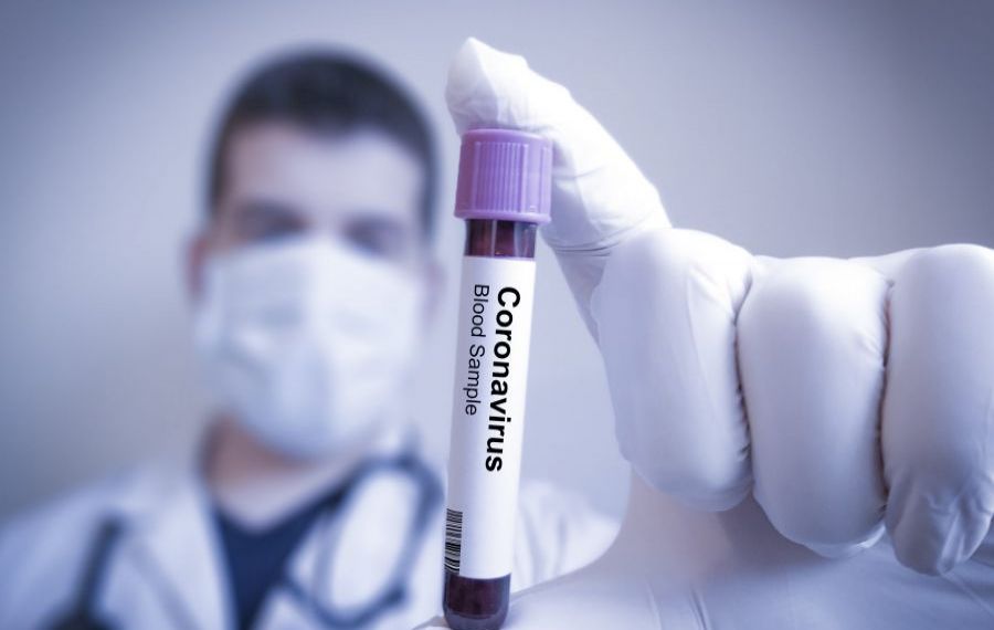 Se schimbă regulile de TESTARE pentru coronavirus