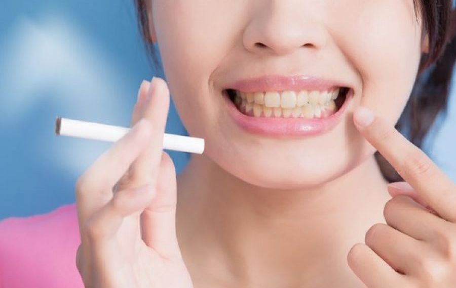 TUTUNUL pătează dinții? Cum poate fi prevenită îngălbenirea danturii