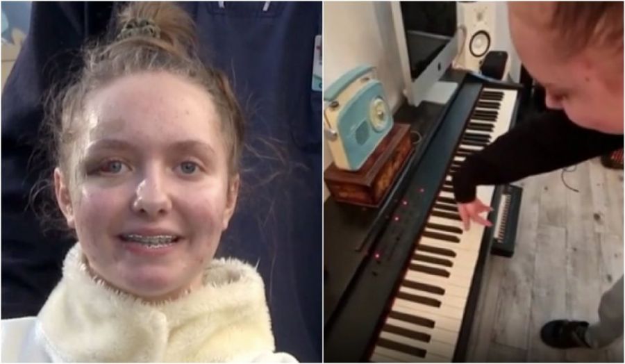 Alexia, fetița cu brațele replantate, a început să CÂNTE la pian